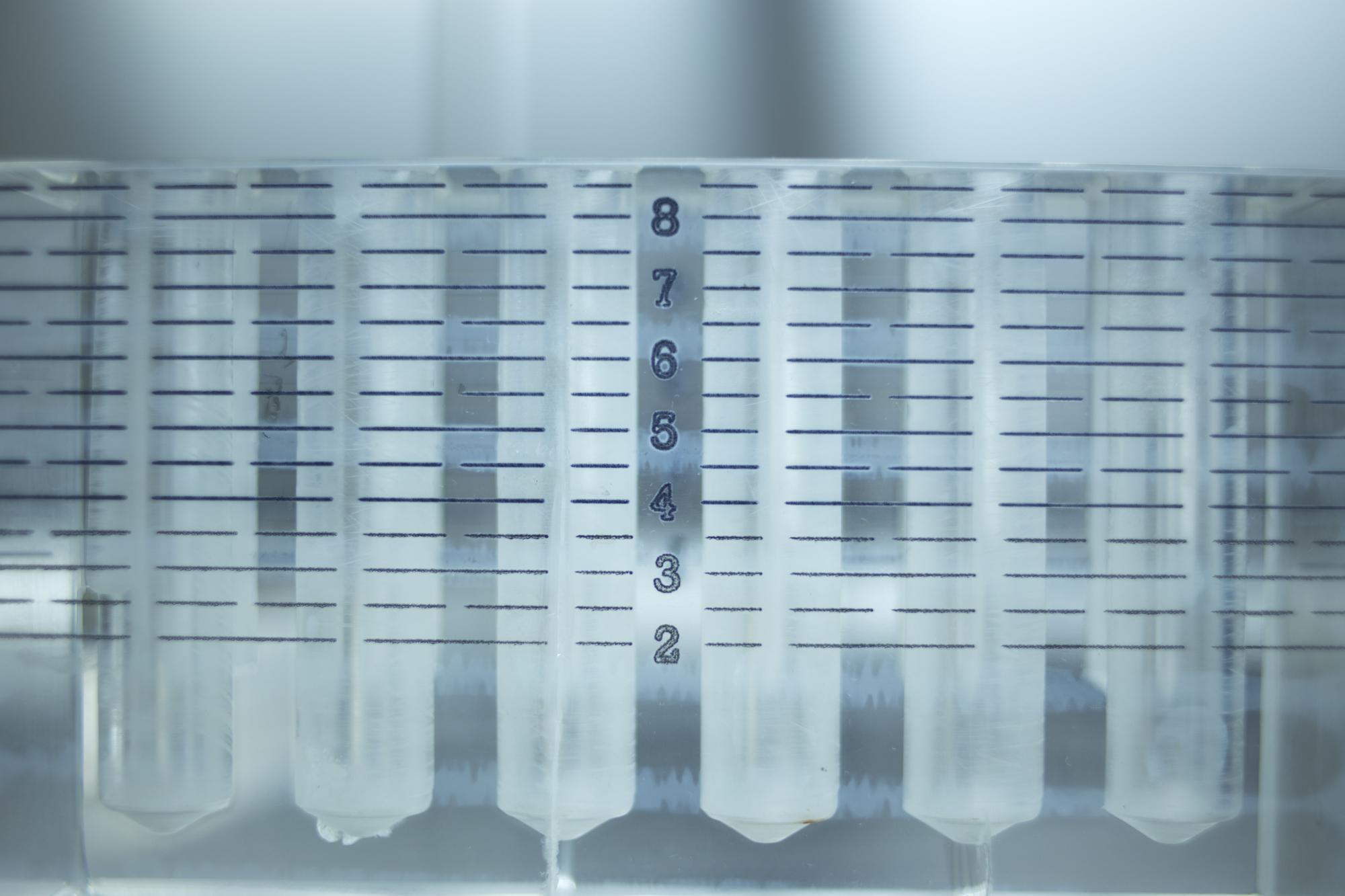 Detail: labeled sample vials and protocol sheets